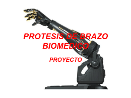 PROTESIS DE BRAZO BIOMEDICO