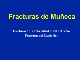 12- Muñeca - Fracturas - lerat