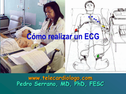 1.3.- Cómo realizar un ECG