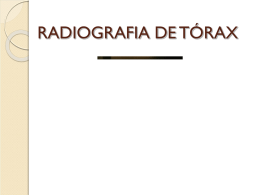 RADIOGRAFIA DO TÓRAX - Sociedade Clemente Ferreira
