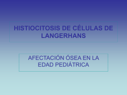 HISTIOCITOSIS DE CÉLULAS DE LANGERHANS