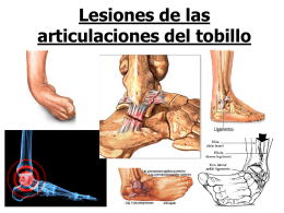 Lesiones de las articulaciones del tobillo
