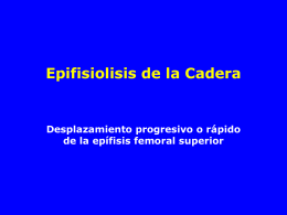 09- Epifisiolisis de Cadera - lerat