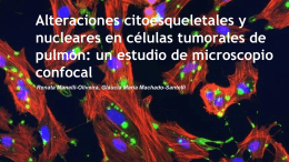 Alteraciones citoesqueletales y nucleares en células tumorales de