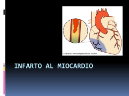 Infarto al miocardio - MOP-UNAB