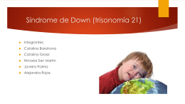 Síndrome de Down (trisonomía 21)