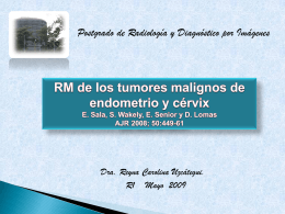 RM de los tumores malignos de endometrio y cérvix E. Sala, S