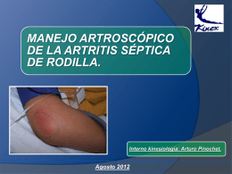 artritis Séptica