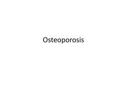 Osteoporosis es una disminucion progresiva de la