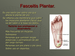 Fasceitis Plantar.