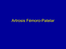 Artrosis fémoro