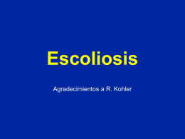 Escoliosis - lerat