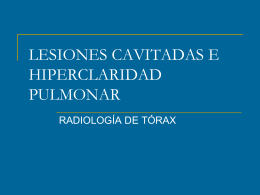 LESIONES CAVITADAS E HIPERCLARIDAD PULMONAR
