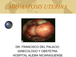 Miomas Uterinos - Clases y Libros