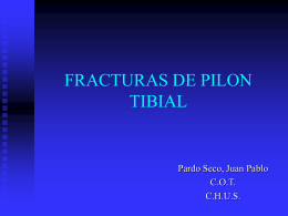 FRACTURAS DE PILON TIBIAL - SOGACOT