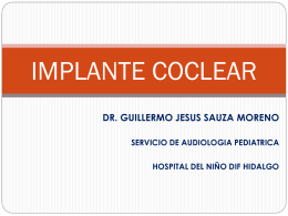 IMPLANTE COCLEAR - asesordos