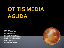 OTITIS MEDIA AGUDA