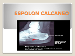 ESPOLON CALCANEO - uneve2311 | Just another …