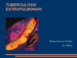 Tuberculosis Extrapulmonar - Portal del Departament d'Alcoi