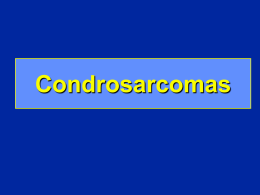 Condrosarcomas - lerat
