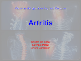 Que es artritis