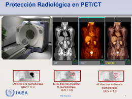 RADIATION PROTECTION IN PET/CT