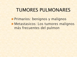 TUMORES PULMONARES