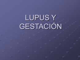 LUPUS Y EMBARAZO - Test Page for Apache Installation