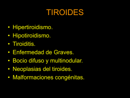 TIROIDES