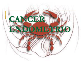 CA ENDOMETRIO - .:: Dr. Kenneth Loaiciga