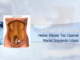 Cancer de Ovario
