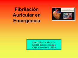 Fibrilacion Auricular en emergencia