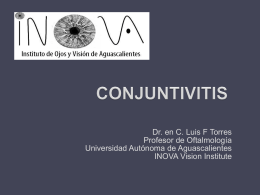 CONJUNTIVITIS - .:: INOVA Vision Institute ::.