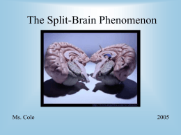 The Split Brain Phenomenon Presentation