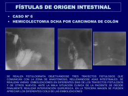 fstulas_de_origen_intestinal_copy5
