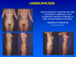laserlipolisis - dr. santiago umaña díaz