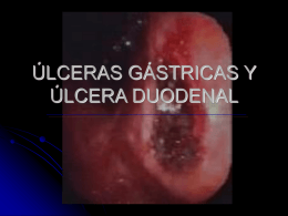 022-Úlceras Gástrica y Duodenal