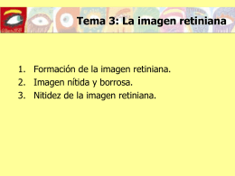 Formación de la imagen retiniana