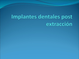 Implantes dentales post extracción