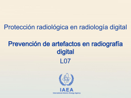 07. Prevención de artefactos en radiografía digital