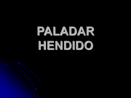 PALADAR HENDIDO