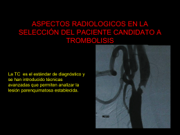 Aspectos radiológicos para Trombólisis del Infarto cerebral.