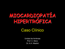 miocardiopatía hipertrófica - Cardiología en Madrid