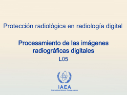 05. Procesamiento de las imágenes radiográficas digitales