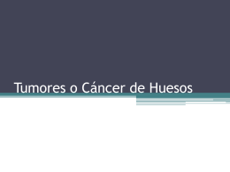 tumores o cáncer de huesos - Dr. Aaron Ruiz Morfín Traumatologo