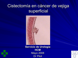 Cistectomia_en_cancer de_vejiga superficial
