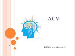 ACV - Webnode