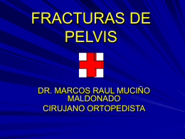 FRACTURAS DE PELVIS.