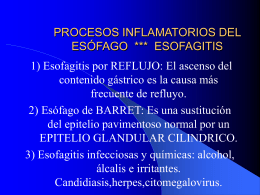 procesos inflamatorios del esófago *** esofagitis