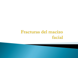 fracturas_faciales